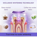 Purple Instant Teeth Whitening Strips – 14 Treatments