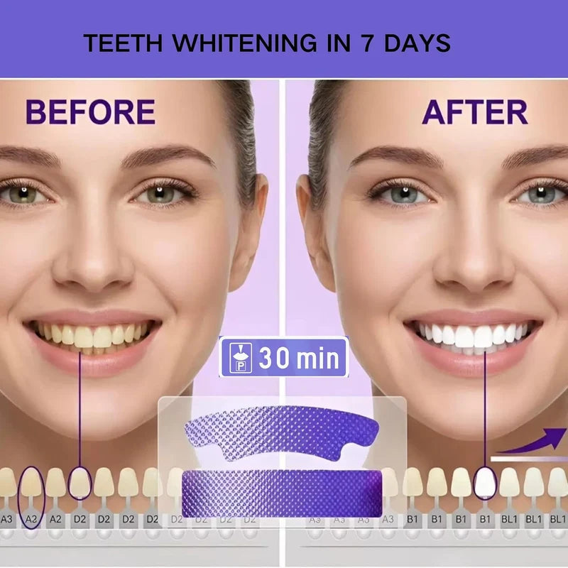 Purple Instant Teeth Whitening Strips – 14 Treatments