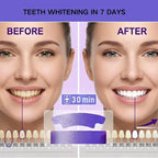 Purple Instant Teeth Whitening Strips – 14 Treatments